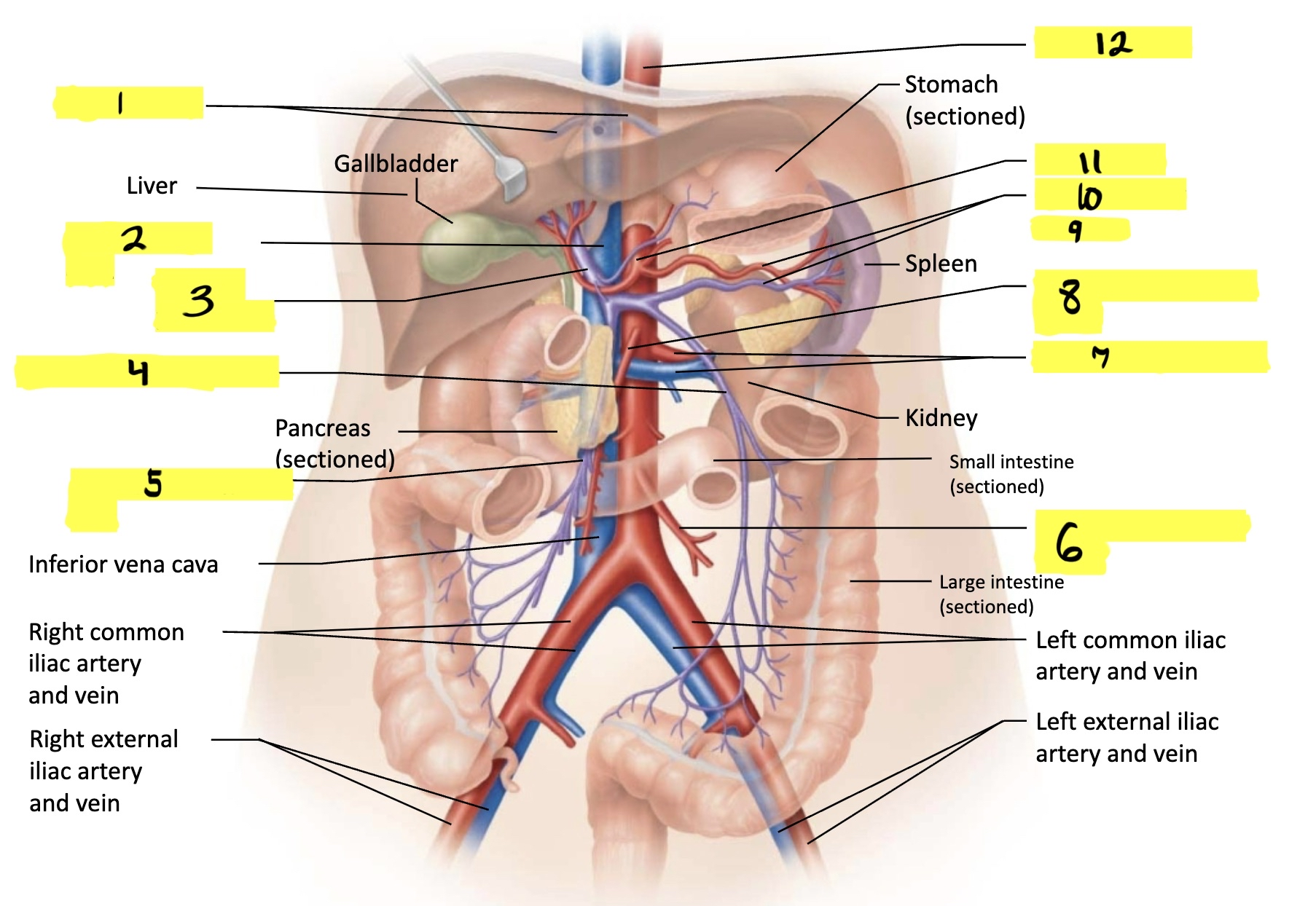 <p>what is #4 in this image?</p>