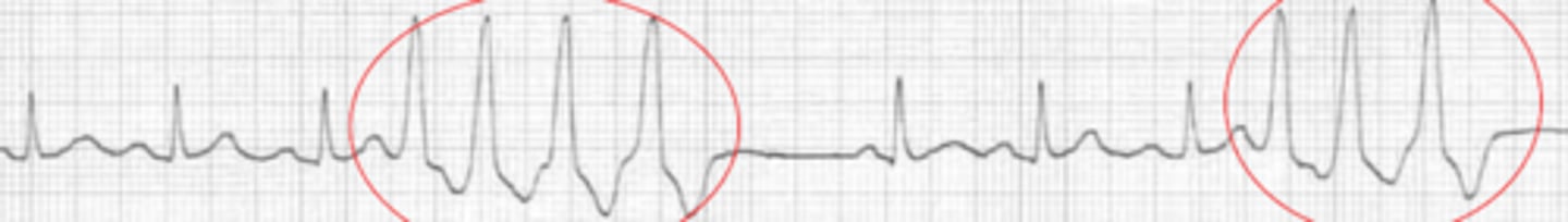 <p>Name the rhythm</p>