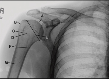<p>A</p>
