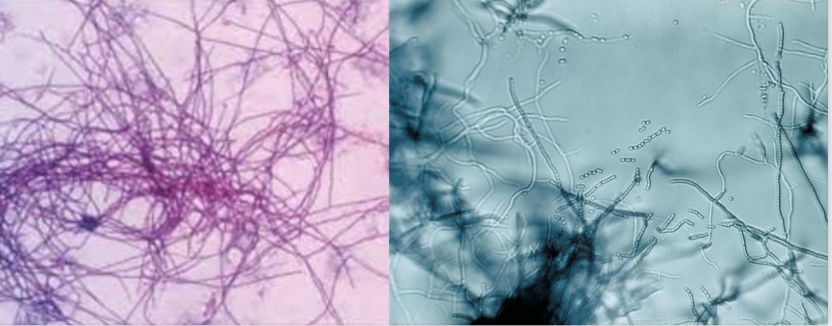 <p>Streptomyces sp. - promieniowce - hodowla</p>