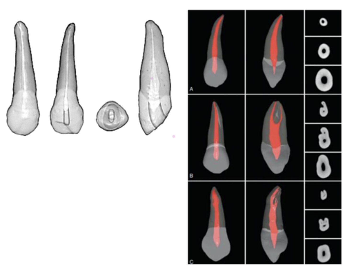 <p>maxillary canine</p>
