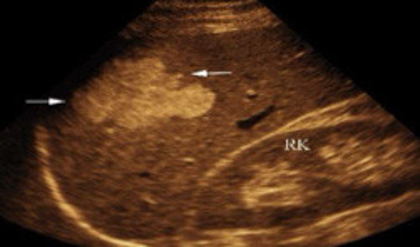 <p>What does this image show</p>