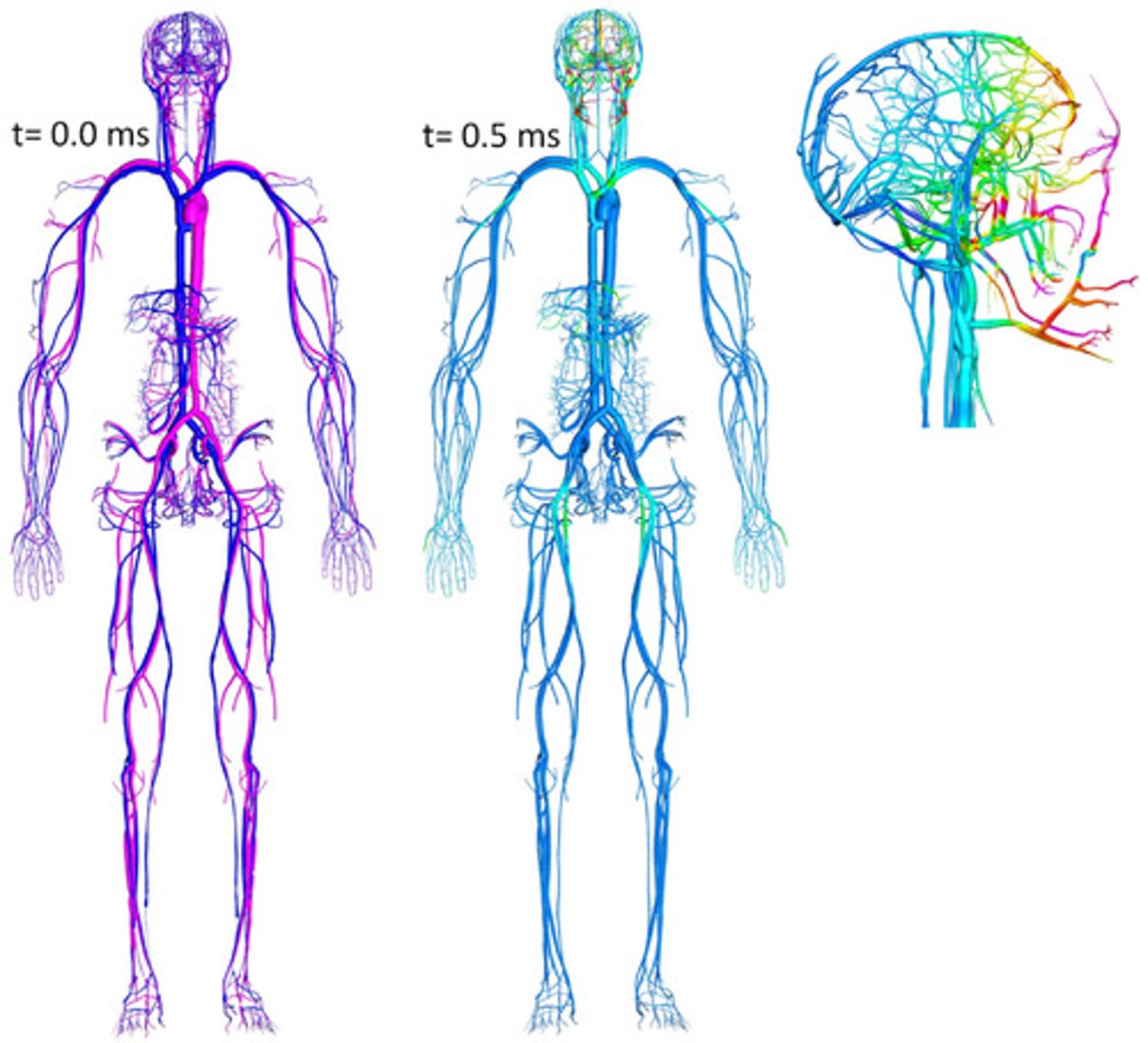 <p>Vein</p>