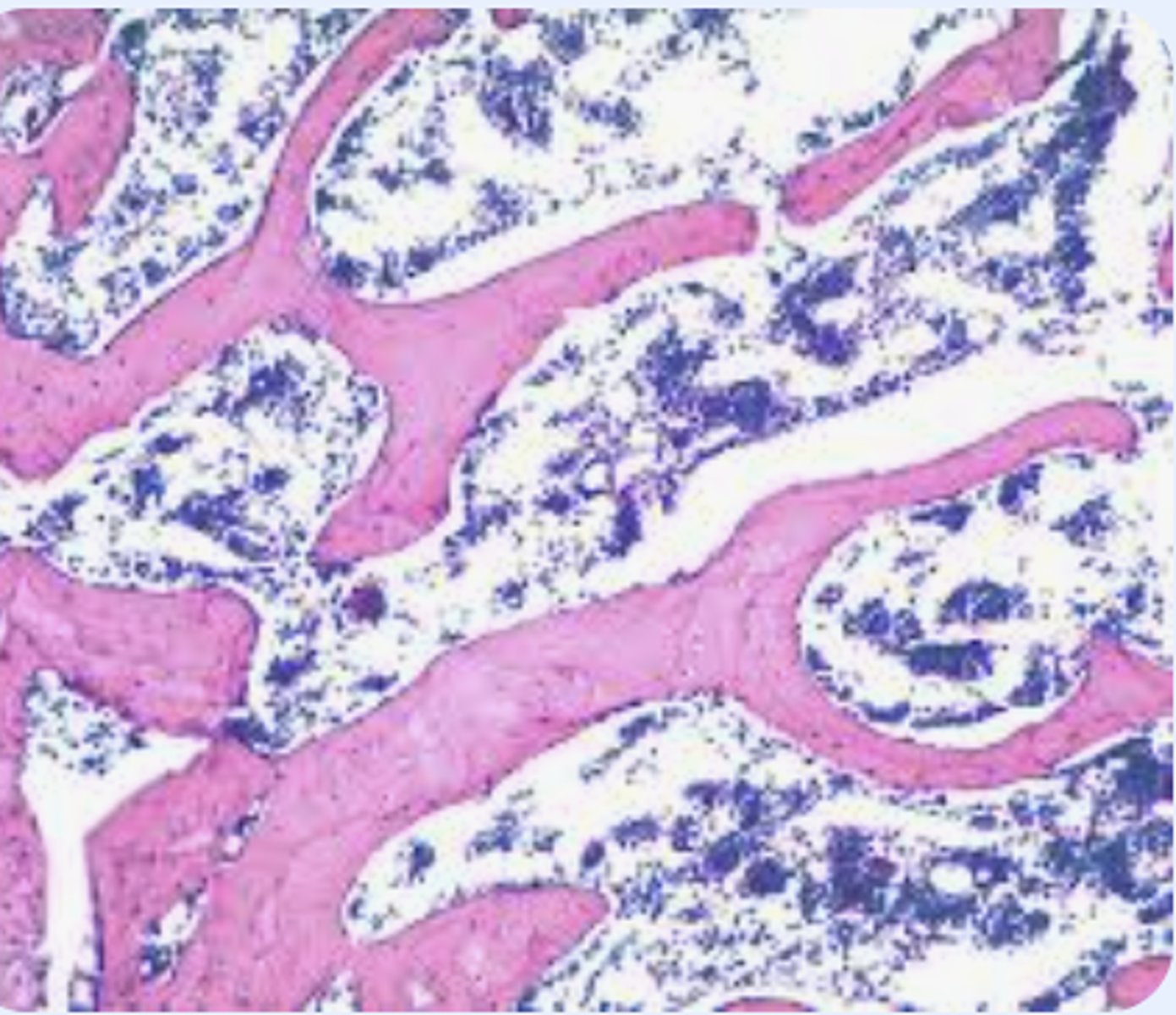 <p>A type of bone tissue that is found on the inside of the bone and can be deformed without fracturing</p>