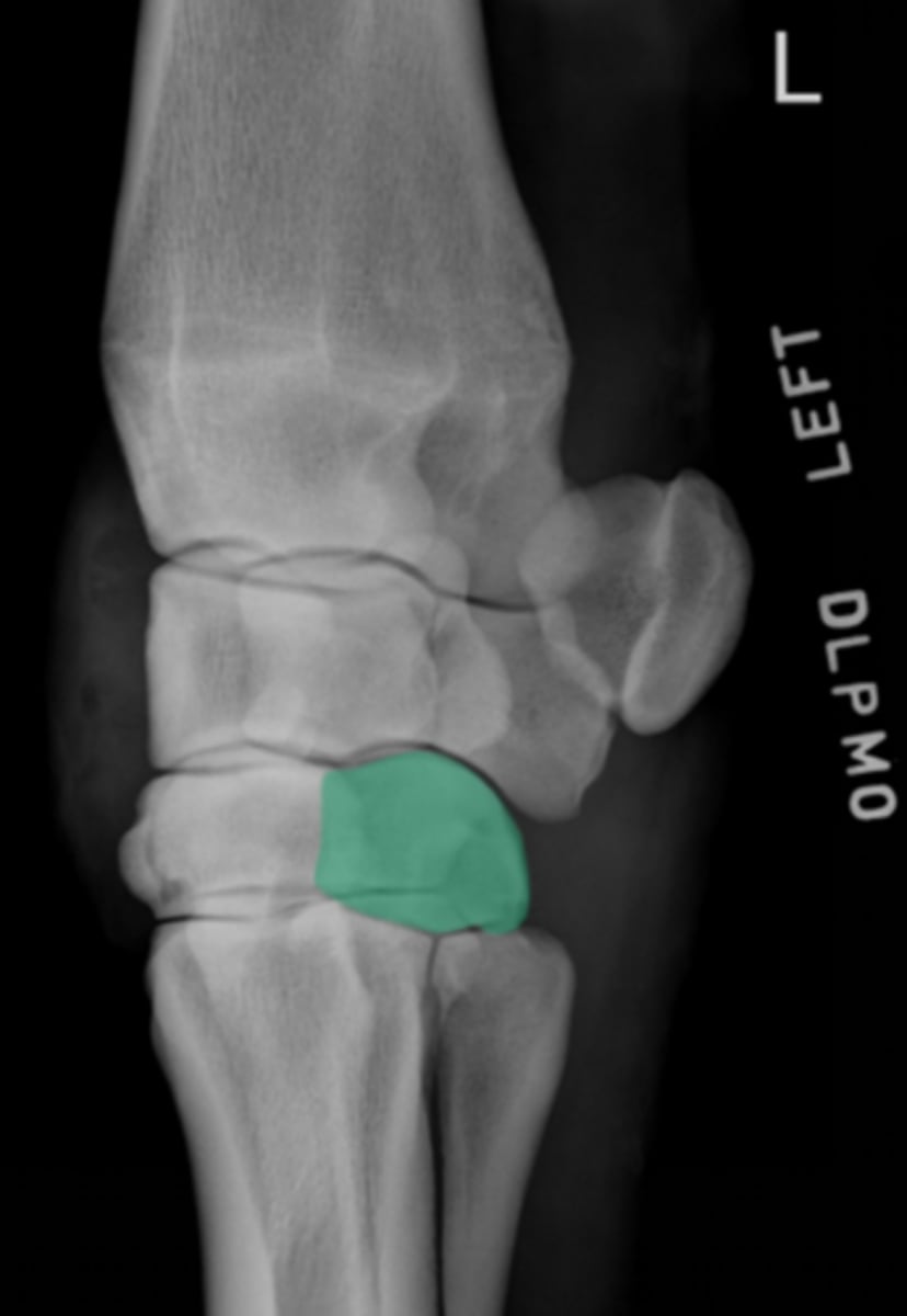 <p>What bone is highlighted?</p>