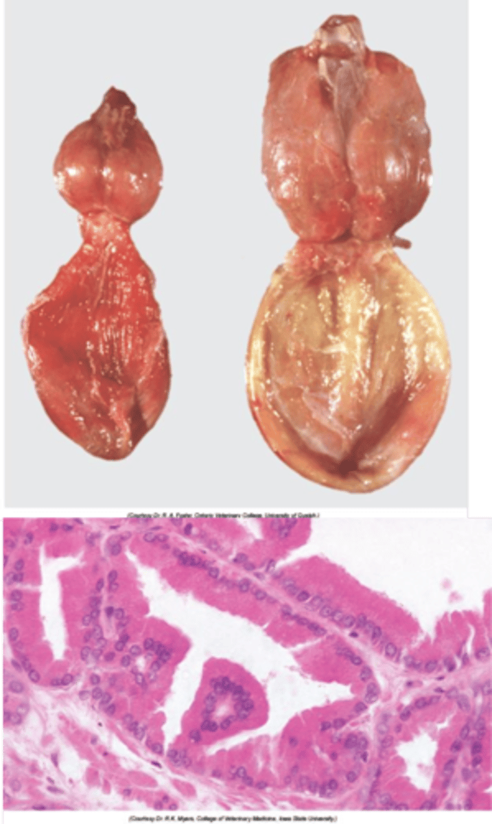 <p>Enlargement of the prostate due to increased number of prostatic cells:</p><p>- Testosterone, converted to DHT in the prostate plays a significant role in the enlargement of the prostate in intact male dogs.</p><p>- Oestrogen can contribute to prostatic changes, as it acts synergistically with androgens to potentiate hyperplasia of the epithelium. This occurs especially in neutered male dogs (and also intact older male dogs as testosterone decreases with age). When testosterone levels decrease, and oestrogen can have a more significant impact because of a decrease in the inhibitory effects of testosterone on oestrogen receptors in the prostate.</p><p>- Most common in old entire dogs </p><p>- Causes constipation and/or urinary stasis </p>