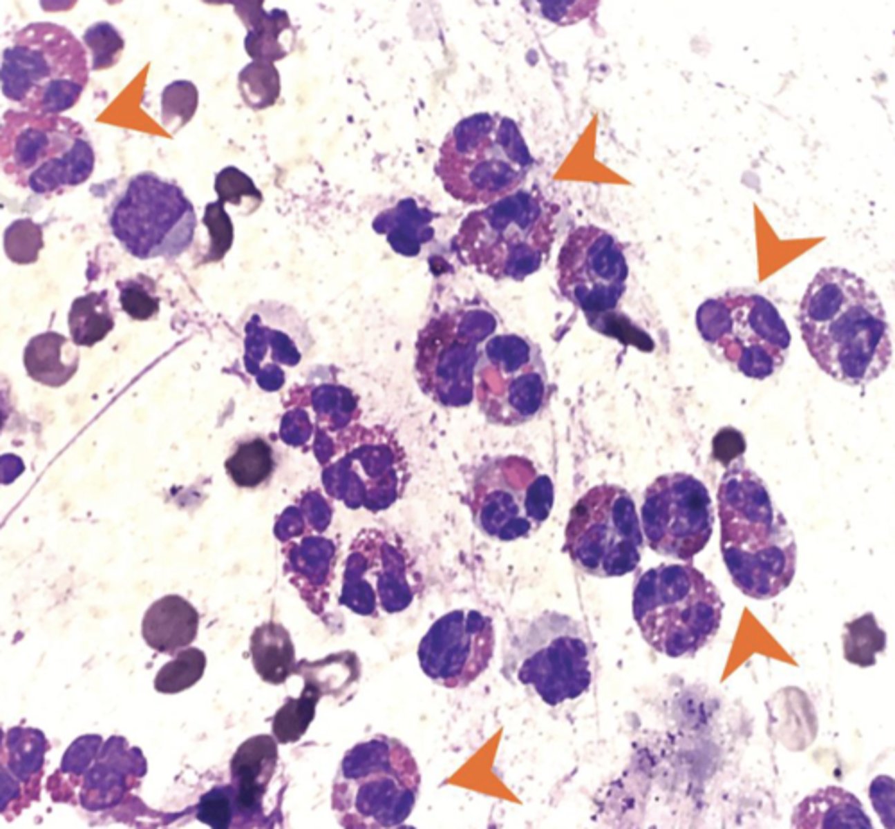 <p>What type of inflammation is this?</p>