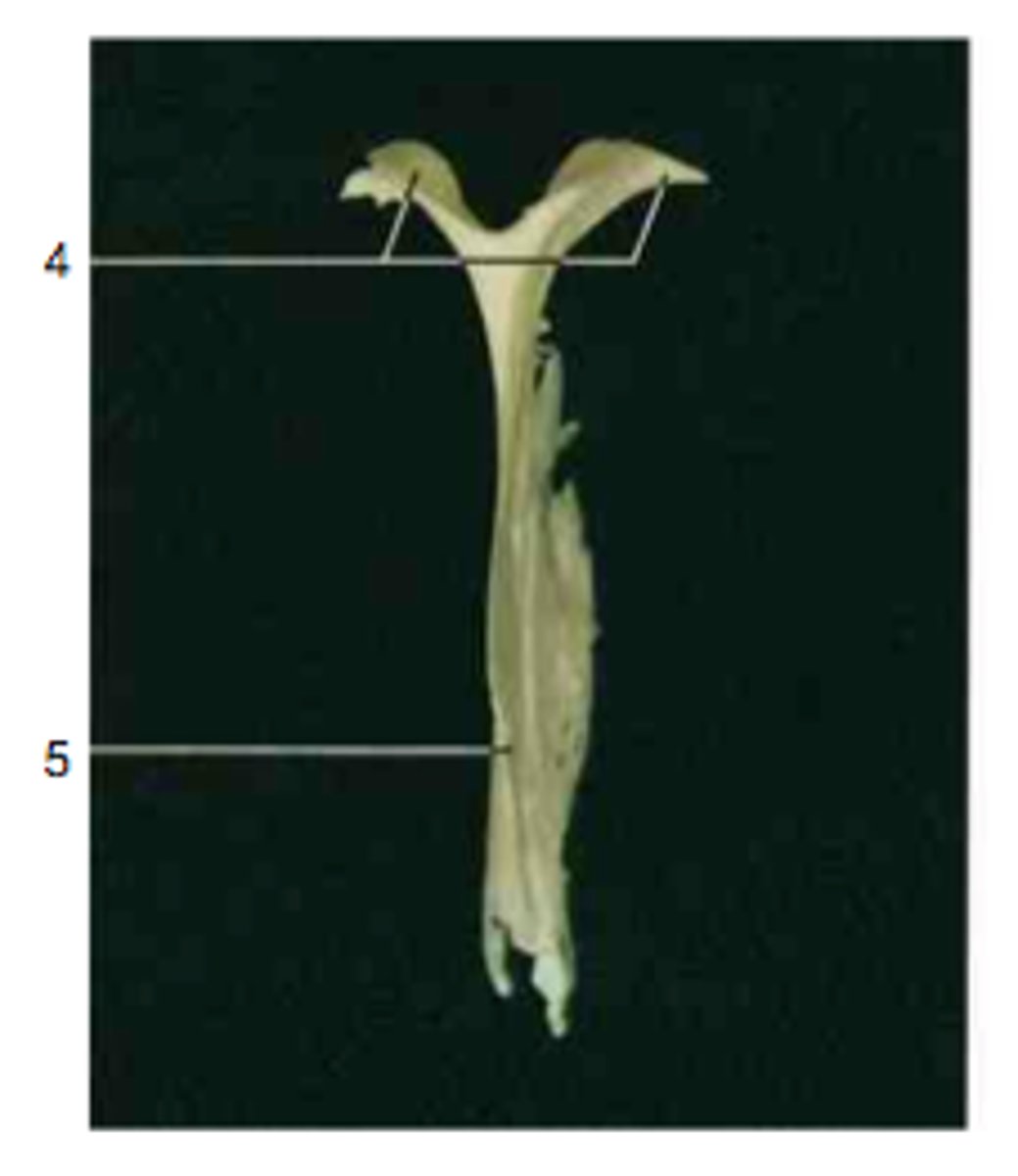 <p>what feature of vomer is this? (#5)</p>