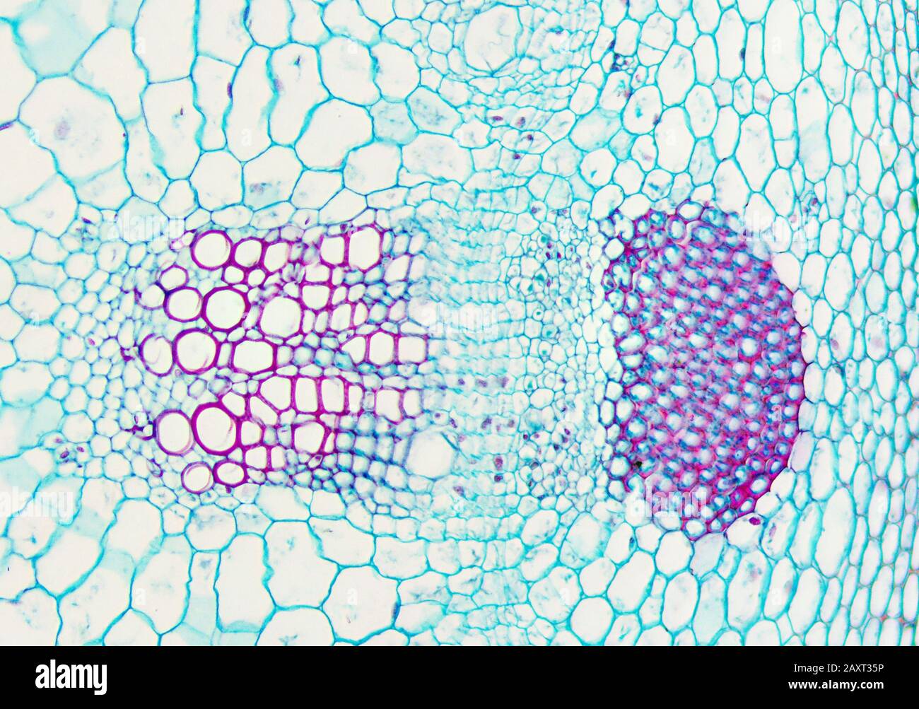 <p><strong>Xylem + Phloem</strong></p>