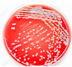 <p>Hemolysis Type?</p>