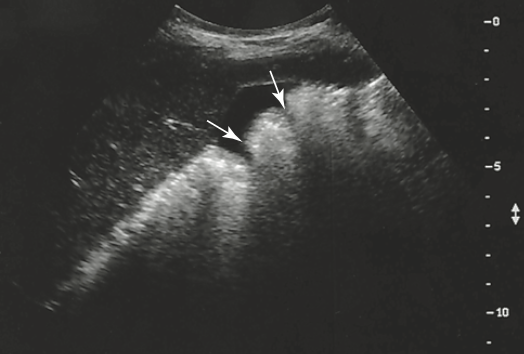 <p>what are the arrows point to</p>