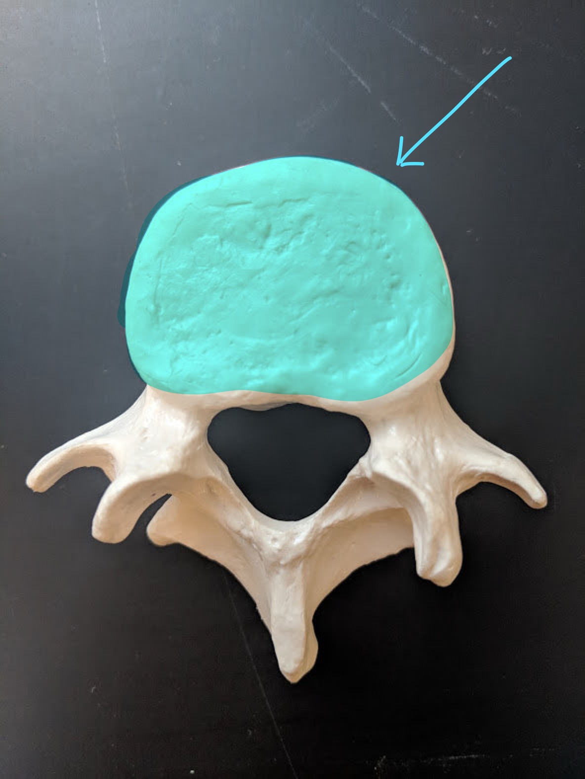 <p>Name this structure</p>