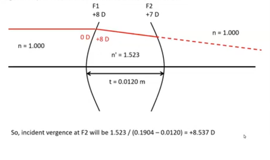 <p>input numbers into BVP equation</p><p>or ray trace and check using formula</p><p>flat form lens- biconvex lens</p><ol><li><p>light travelling from a source at infinity so has 0D when hits front surface </p></li><li><p>need to determine vergence of light immediately after front surface </p></li><li><p>to do this, 0D + 8 = 8D </p></li><li><p>light converges to F2, so dioptric power goes up </p></li><li><p>imagine the light after converging carries on throughout - dashed lines , to work out how far it needs to travel to hit focal point </p></li><li><p>1.523/+8 = 0.1904m :rays would form a focus at this distance if the lens was really thick ( this is 16 lens thicknesses ), but it is not its 0.012</p></li><li><p>to work f2 vergence, subtract thickness of lens from the back focal length of F1 - 1.523/8 = 0.1904m </p></li><li><p>so F2 incident vergence - 1.523 / (0.1904-0.012) = +8.537 D #</p></li><li><p>this shows the vergence as it just hits F2 </p></li></ol><p></p><p></p>