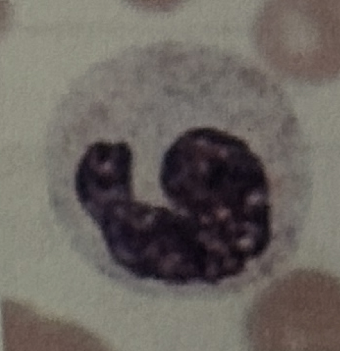 <p>WBC</p>