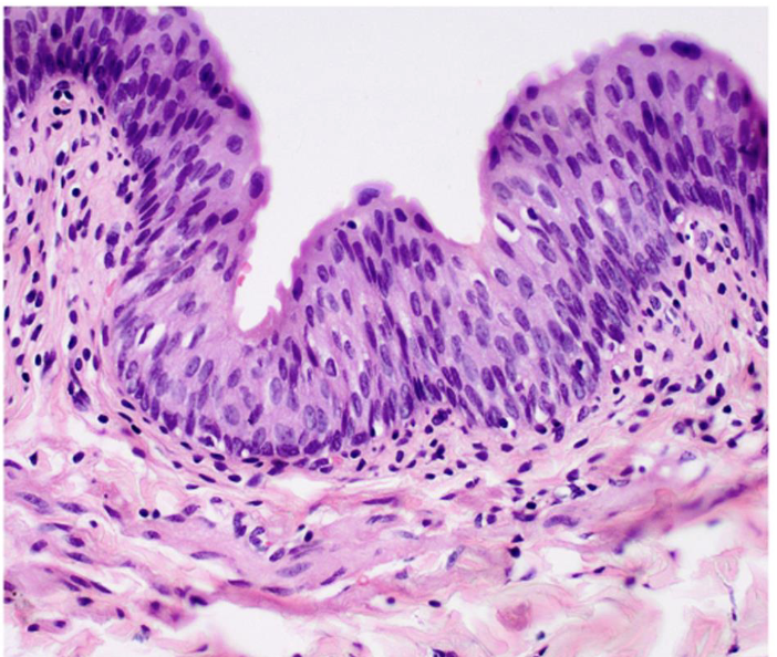 <p>what tissue is this </p>