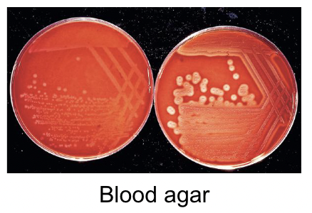 <p>Blood agar </p><p>Small greyish colonies </p><p>Weak beta hemolytic </p>