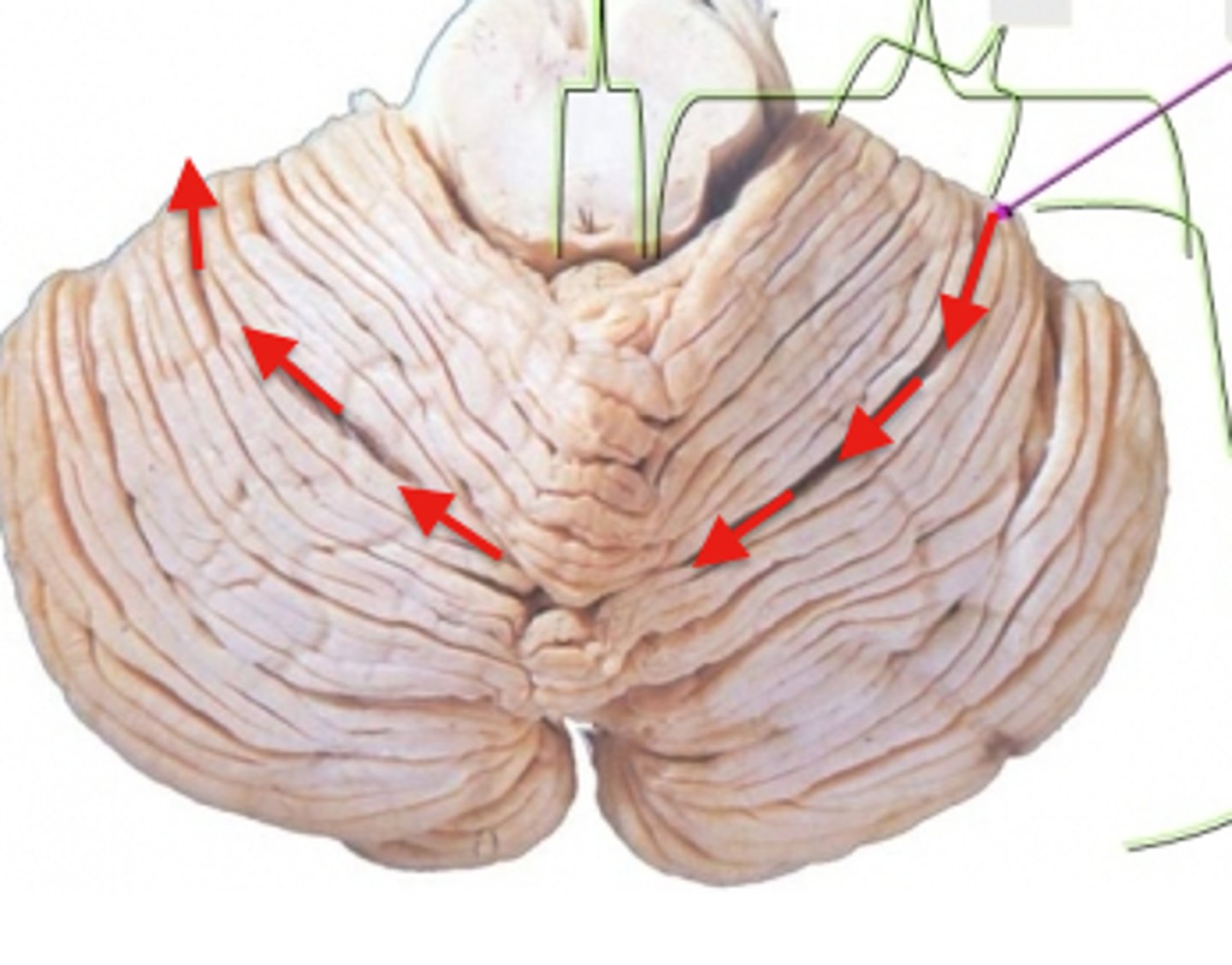 <p>What is this dividing line that separates the Anterior and Posterior lobes of the cerebellum?</p>
