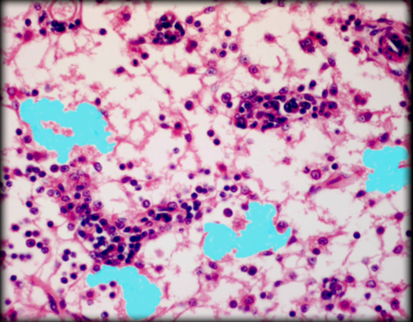 <p>Lymph node</p>