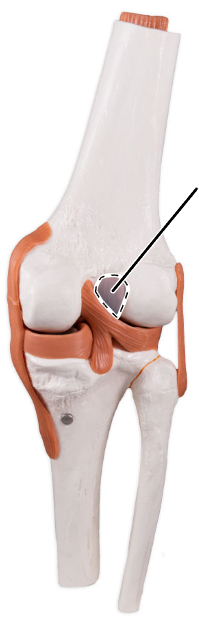 <p>What ligament is shown here?</p>