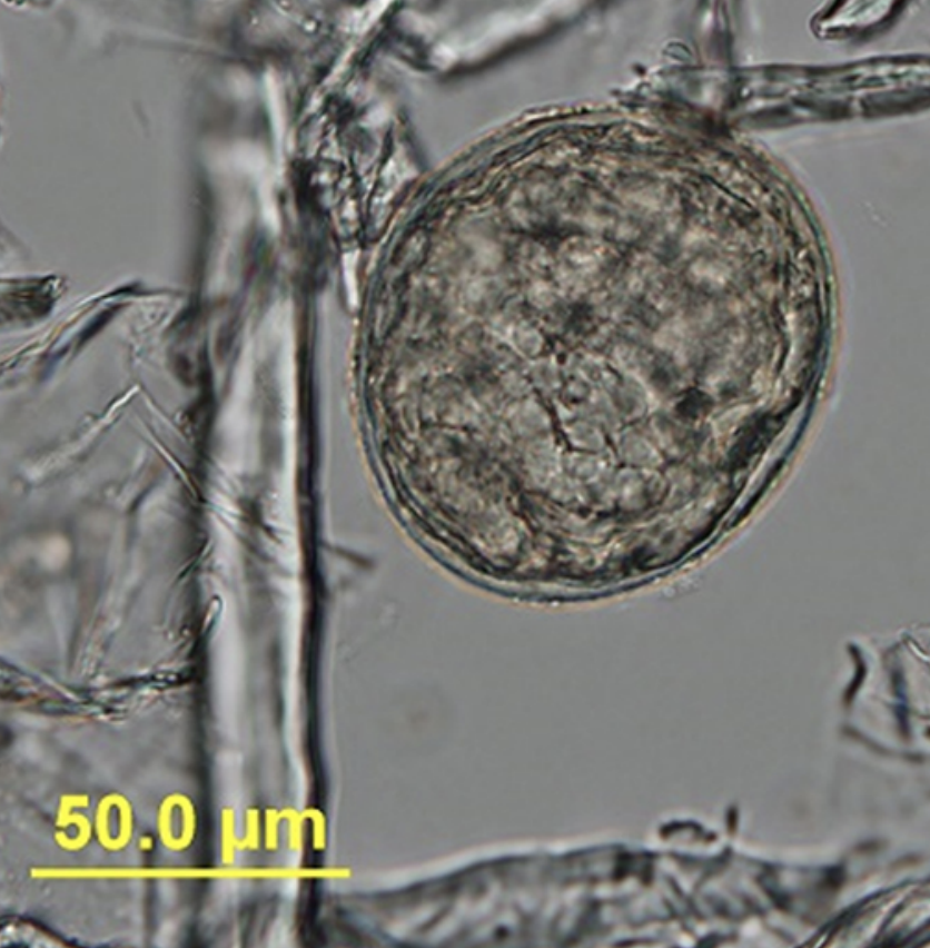 <p>1. saline fecal sedimentation</p><p>2. fecal PCR at texas A&amp;M GI lab</p><p>3. <strong>histology of intestinal and liver biopsies (most reliable method- may reveal eggs and parasites with granulomatous inflammation)</strong></p>