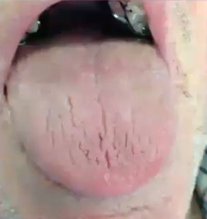 <p>what is the diagnosis </p>