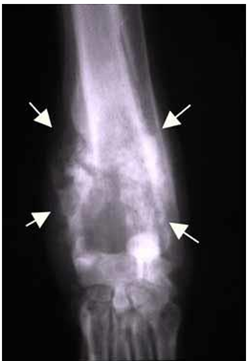 <p>which condition is this?</p>