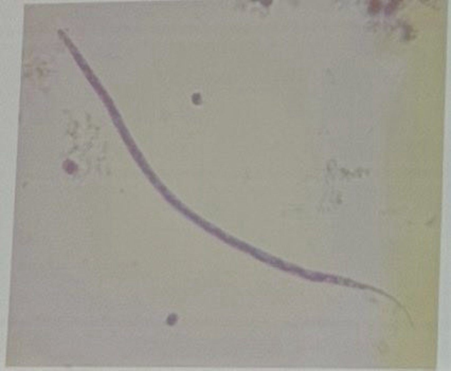 <p>Dirofilaria immitis</p><p>3 multiple choice options</p>