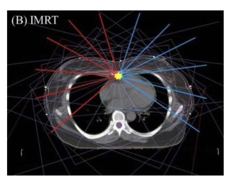 <p>Radiotherapy &amp; Side effects</p>