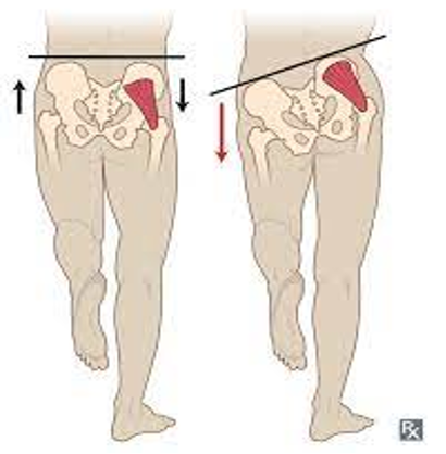 <ul><li><p><strong>weakness of hip abductors, gluteus medius &amp; minimus</strong></p></li><li><p>pt stand on one leg</p></li><li><p>positive = pelvis of lifted leg tilts downward or drops </p></li></ul><p></p>