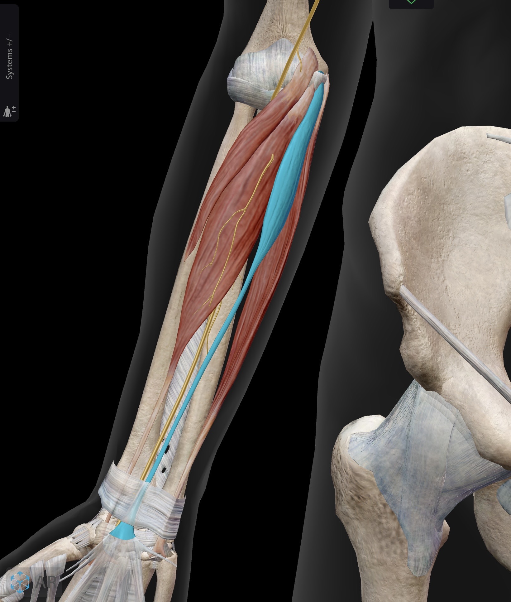 <p>Palmaris longus</p><p>O: Medial epicondyle of humerus (common flexor origin)</p><p>I: palmar aponeurosis (palmar fascia) and flexor retinaculum (transverse carpal ligament)</p><p>A: Flexion of the hand at the wrist joint</p><p>IN: Median nerve (C5-C8, T1)</p><ul><li><p>Not everyone has palmaris longus muscle</p></li></ul><p></p>