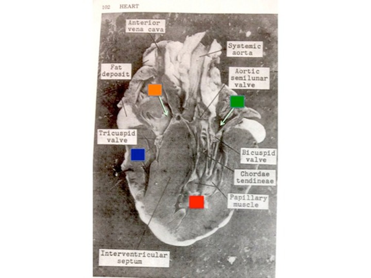 <p>What is the chamber the orange box pointing to?</p>