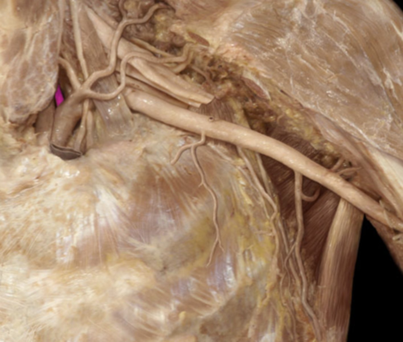 <p>Name the Artery</p>