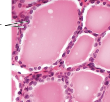 <p>follicular cells</p>