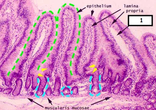<p>What is the structure outlined in green</p>