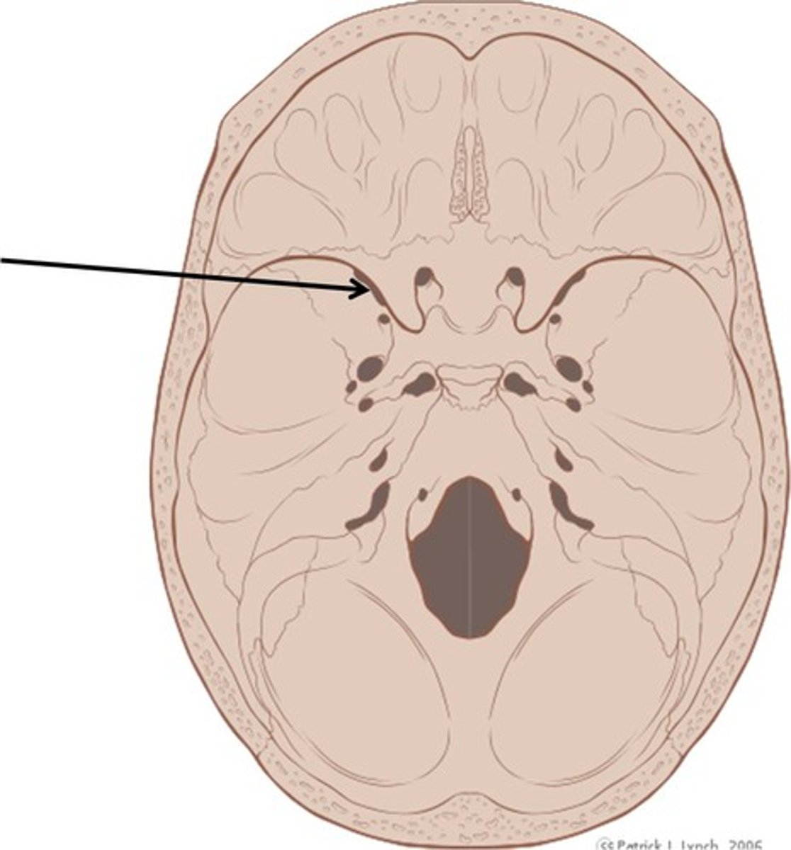 <p>Deep groove of the brain</p>
