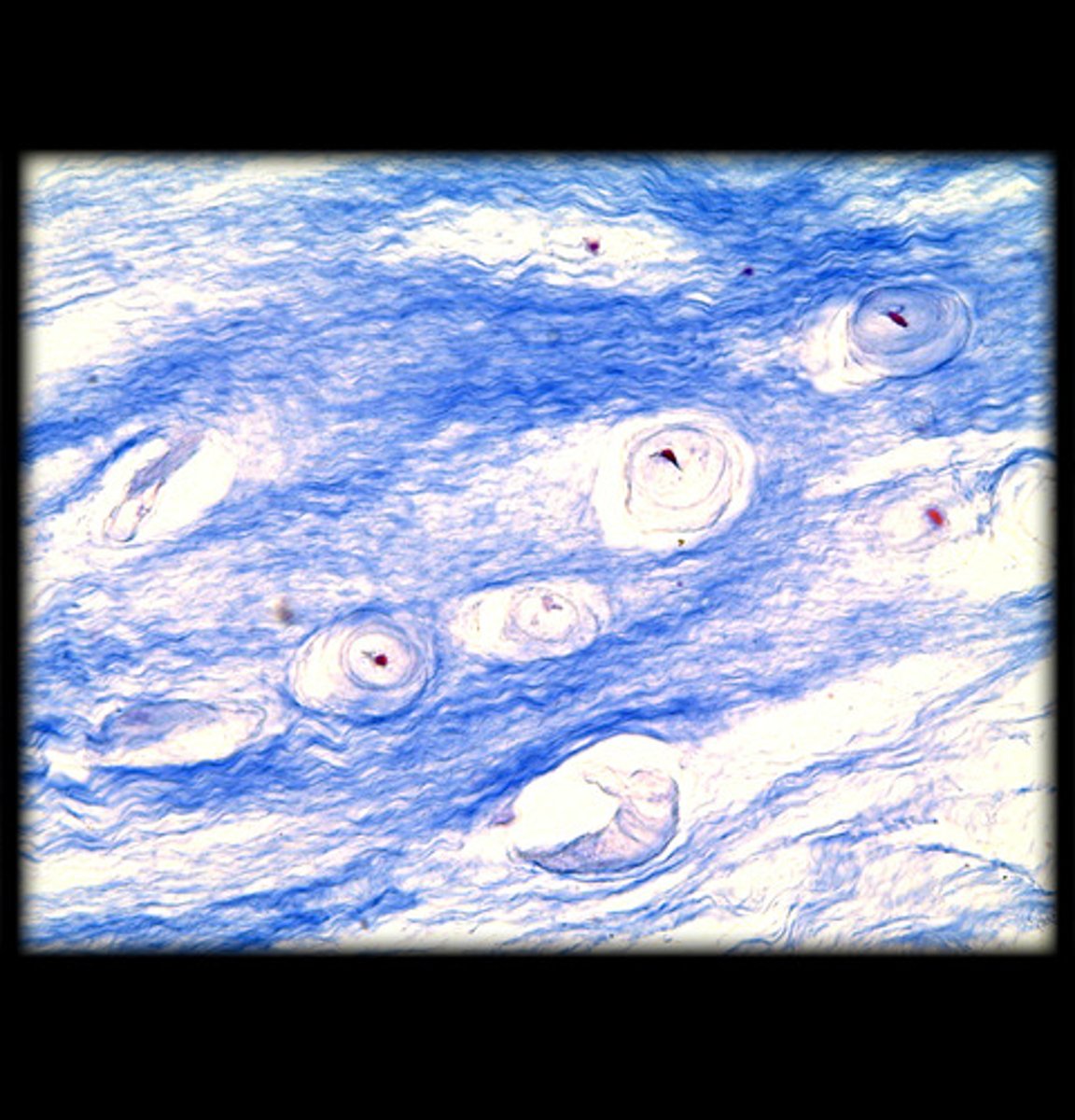 <p>- Thick, dense bundles of collagen fibers in the matrix. Chondrocytes are visible but surrounded by a more fibrous matrix.</p><p>- Appears as wavy, densely packed collagen fibers, often arranged in rows.</p><p>- Found in intervertebral discs and pubic symphysis.</p>