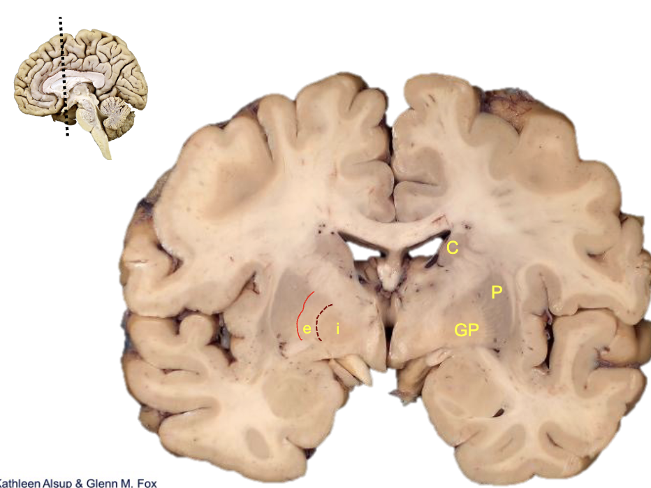 <p><strong>what is e?</strong></p>