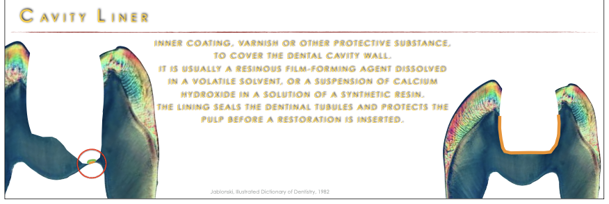 <ul><li><p>It is in the coating, varnish, or other protective material to <strong>cover</strong> the dental cavity wall and protect dentin and pulp from sensitivity </p></li><li><p>Usually a resinous film-forming agent in a volatile solvent, or a suspension of hydroxide in a solution of a synthetic resin. </p></li></ul><p></p>