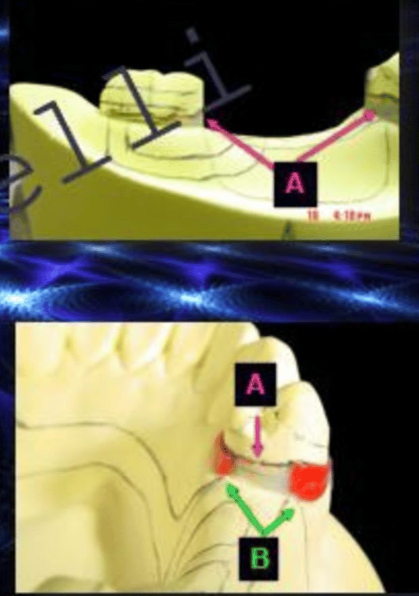 <p>ID the type of block out at A:</p>