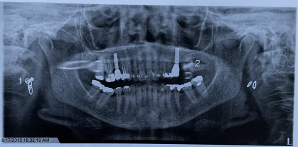 term image