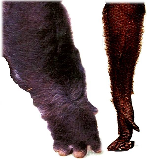 <p><span>hominoid&nbsp;wrist joint flexibility is accompanied by&nbsp;susceptibility to this</span></p><p><span>Asian apes (gibbons, orangutans) must avoid weight-bearing at the heel of the hand. In contrast,&nbsp;African apes (gorillas, chimps) have specialized knuckle-walking adaptations that lock the wrist straight so&nbsp;that&nbsp;the heel of the hand cannot touch the ground during terrestrial locomotion.</span></p><p><span>Human bipedalism allows ground&nbsp;travel without weight-bearing by hands but our hands are employed in other ways&nbsp;<em>(e.g.,</em>&nbsp;typing, texting, gaming, playing the violin, etc.)&nbsp;that can result in carpal tunnel syndrome (this is a debilitating and painful condition).</span></p><p><span>&nbsp;.&nbsp;</span></p>