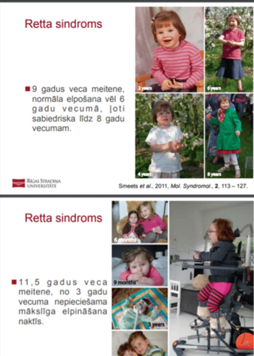 <p>! Lai gan daļai meiteņu ar Retta sindromu piemīt autisma iezīmes, ar laiku tās parasite izzūd un pieaugušas sievietes var būt sociāli aktīvas.</p>