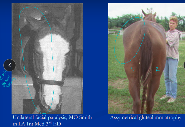 <ul><li><p><span style="color: red;"><strong><u>The most common infectious equine CNS disease</u></strong></span></p><ul><li><p>brainstem &amp; spinal cord most common</p></li></ul></li><li><p><span style="background-color: transparent;"><strong><span>Et: </span></strong></span><span style="background-color: transparent; color: green;"><u><span>Sarcocystis neurona</span></u></span><span style="background-color: transparent;"><u><span>, </span></u><strong><u><span>opossum** → horse dead end host</span></u></strong></span></p><ul><li><p><span style="background-color: transparent;"><span>sporocysts in </span></span><span style="background-color: transparent; color: green;"><span>contaminated feed/water</span></span></p></li><li><p><span style="background-color: transparent;"><strong><span>focal/multifocal gray + white lesions →&nbsp;hemorrhage, and necrosis </span></strong></span></p></li></ul></li><li><p><span style="background-color: transparent;"><strong><span>Cs:</span></strong><span> </span></span><span style="background-color: transparent; color: red;"><strong><u><span>asymmetrical ataxia(side of lesion)</span></u><span>, focal muscle atrophy w/ ±&nbsp; cranial nerve defects:</span></strong></span><span style="background-color: transparent;"><span>&nbsp;</span></span><span style="background-color: transparent; color: red;"><strong><span>facial paralysis</span></strong></span><span style="background-color: transparent;"><span>, dysphagia, LMN signs(spastic hind limbs), </span></span><span style="background-color: transparent; color: red;"><span>CN 5(facial paralysis)</span></span></p></li><li><p><span style="background-color: transparent;"><strong><span>Dt: </span></strong><span>rule-outs, serology, CSF ELISA, necropsy (definitive)</span></span></p><ul><li><p><span style="color: green;">+ serum titer = exposure</span></p></li><li><p><span style="color: green;">S neurona antibodies in serum <strong>&amp;</strong> CSF: both&nbsp;<strong>positive = EPM</strong></span></p></li></ul></li><li><p><span style="background-color: transparent;"><strong><span>Tx:</span></strong><span> ponazuril, diclazuril, sulfadiazine/pyrimethamine(cheap)</span></span></p><ul><li><p>best outcome when tx early! </p></li></ul></li><li><p><span style="background-color: transparent;"><strong><span>Px:</span></strong><span> 60% improve, 20% full recovery, relapses common</span></span></p></li></ul><p></p>