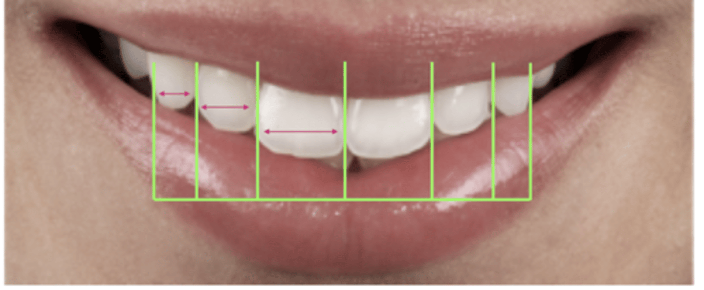 <p>- Golden proportion</p><p>- Recurrent esthetic dental proportion</p>