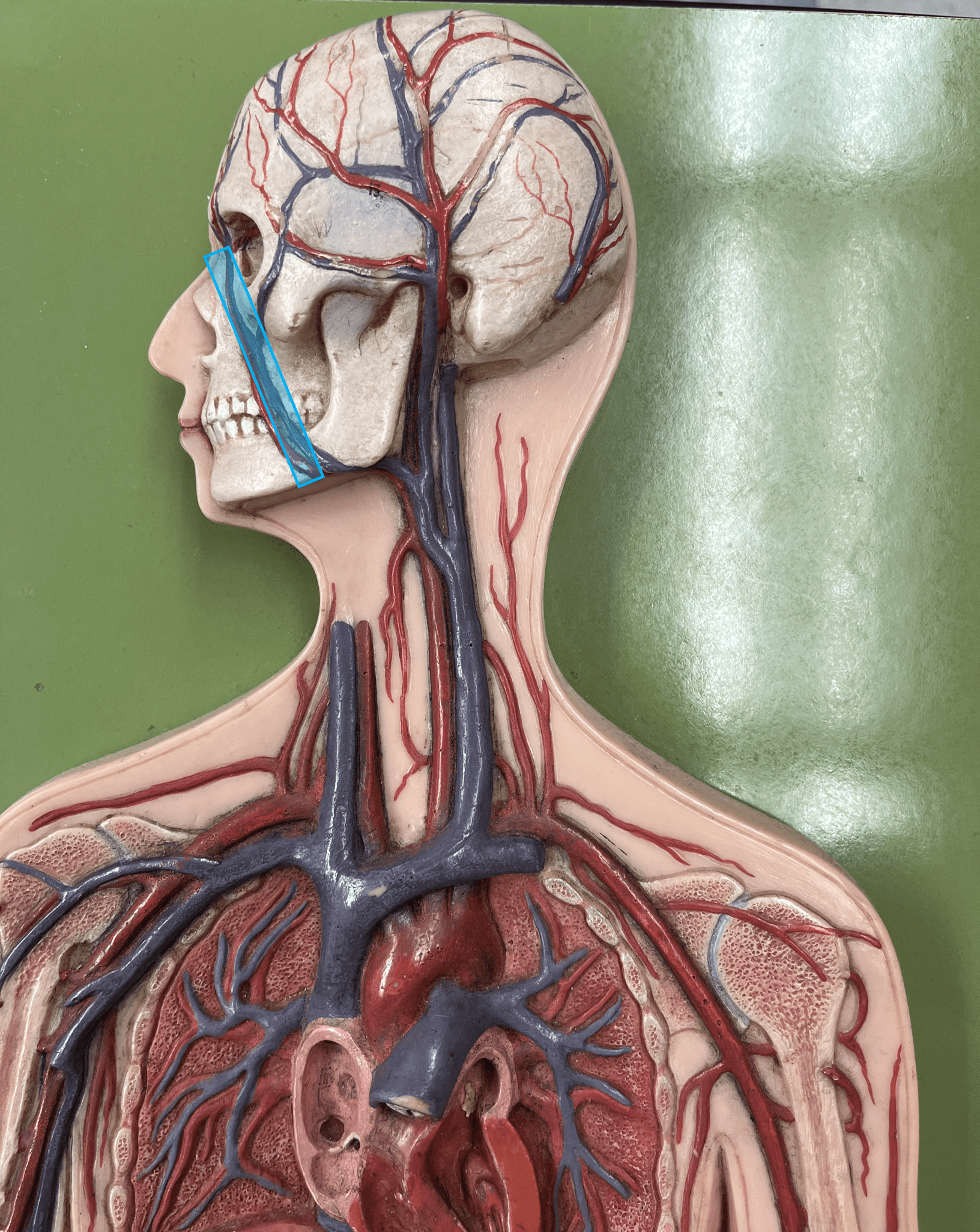 <p>• A vein of the head and neck.</p>
<p>• Drains the skin and muscles of the face.</p>
<p>• Empties into the internal jugular vein.</p>