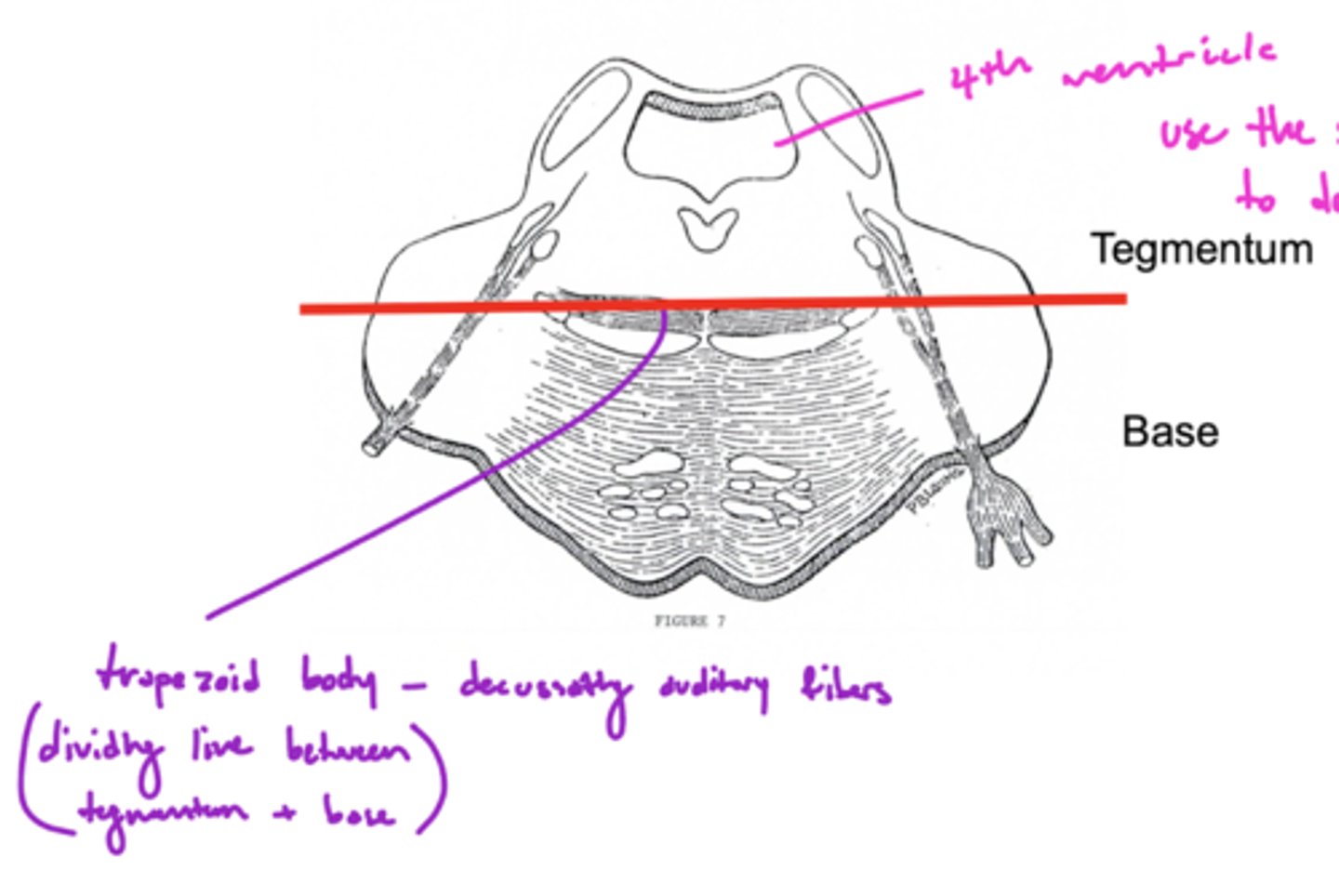 <p>trapezoid body -- decussating auditory fibers</p>