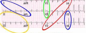 <p>what is each color</p>