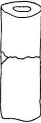what loading type causes this bone failure