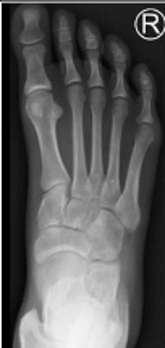 <p>What is the name of the radiographic view?</p>