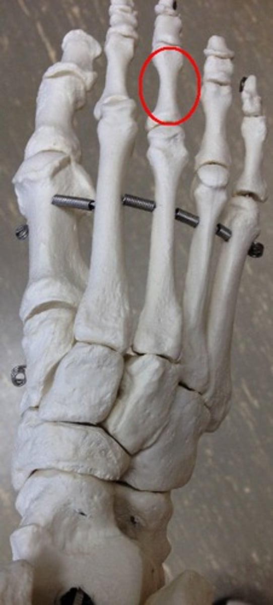 <p>ID bone</p>